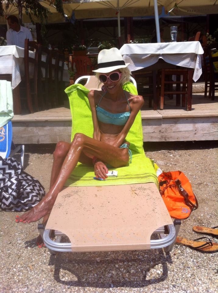 Bony Bitches:  You're Still Too Fat, Cunt! — 10