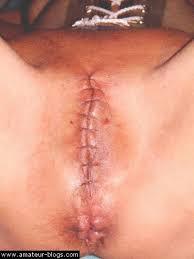 Vaginal torture — 7